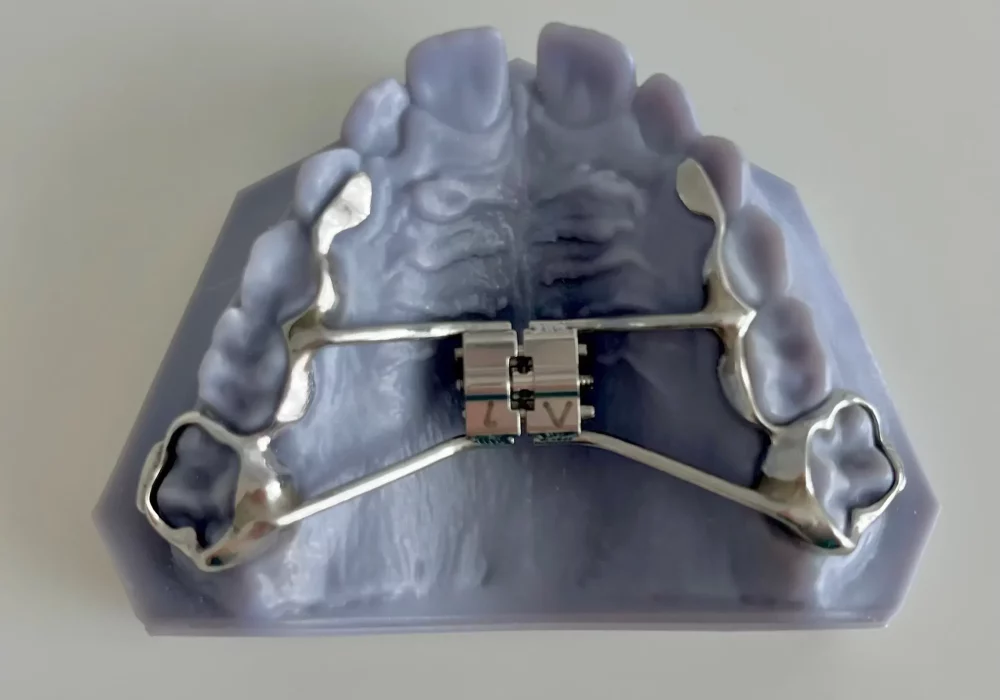 appareil-interceptif orthodontiste libourne