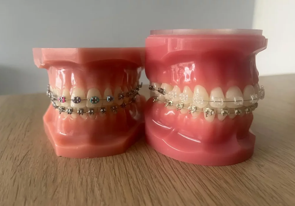 cabinet orthodontie libourne traitement appareil dentaire