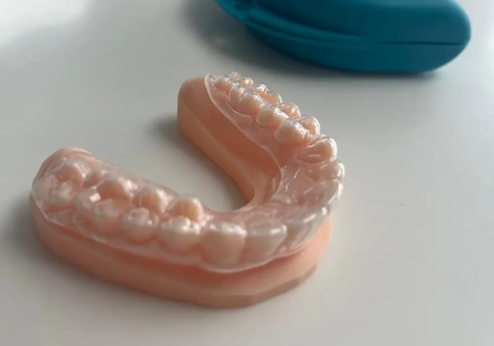 traitement cabinet orthodontie libourne appareil dentaire